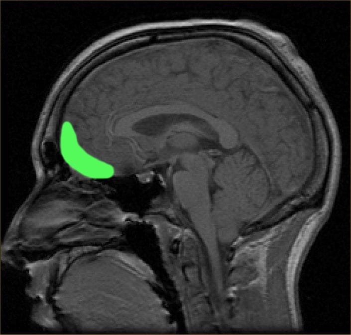 orbitofrontal cortex